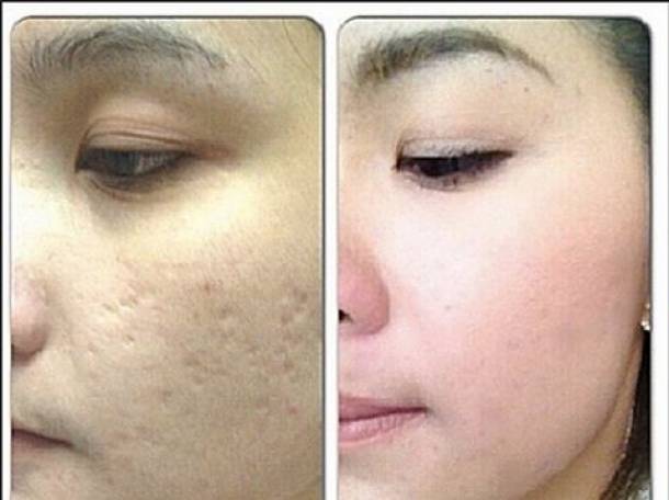 микрокрем Jeunesse Instantly Ageless, VIP косметика, фотография 5