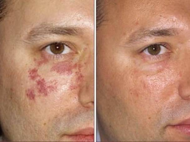 Jeunesse Дневной увлажняющий крем LUMINESCE, VIP косметика, фотография 8