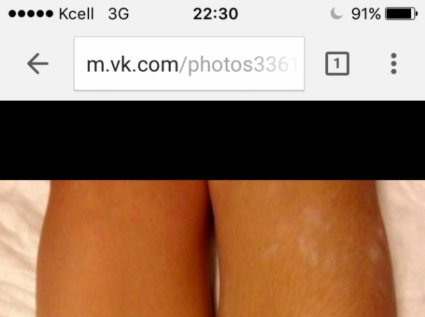 Шугаринг , фотография 3