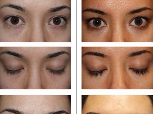 Средство для роста ресниц и бровей Lurey Lash Md, фотография 5