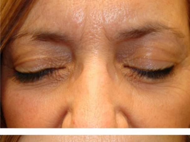 Средство для роста ресниц и бровей Lurey Lash Md, фотография 6