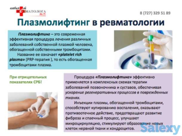 Консультация ревматолога к.м.н. Ph.D. , терапевта высшей категории, 30 летний стаж работы., фотография 5