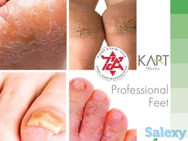 Решение проблем стоп и ногтей в Алматы, фотография 3