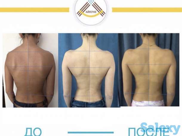 Оздоровительный центр «Айкуне», фотография 4