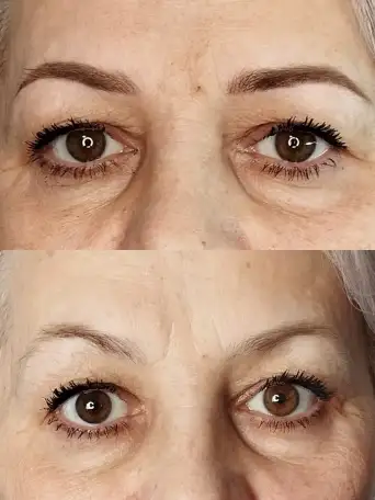 Перманентный макияж, фотография 3