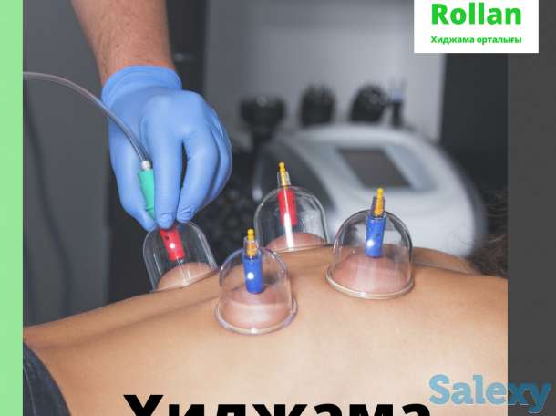Хиджама / Мануальная терапия / Огненный массаж на выезд кәсіби түрде, фотография 1