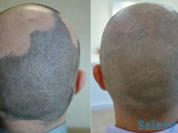 Трихопигментация в Казахстане, фотография 1