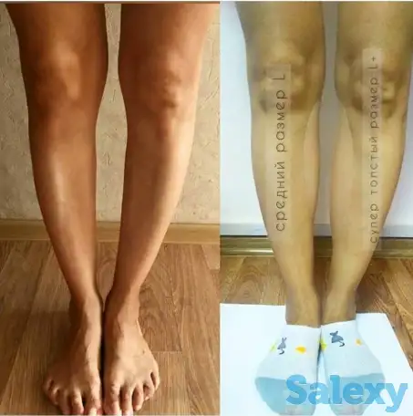 Силиконовые накладки для кривых ног, фотография 11