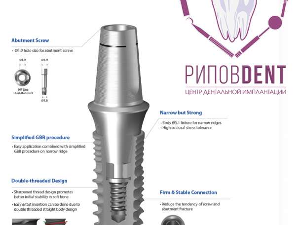 Стоматология, имплантация, фотография 1