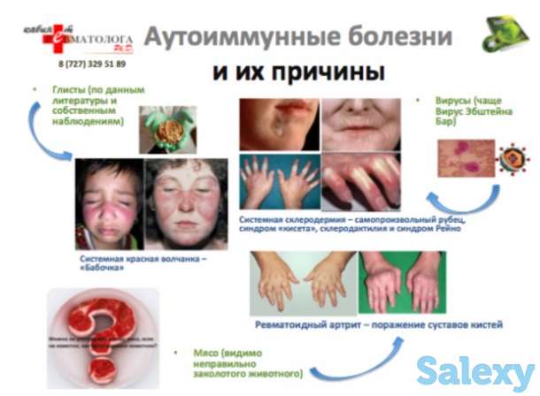 Консультация ревматолога к.м.н. Ph.D. , терапевта высшей категории, 30 летний стаж работы., фотография 2