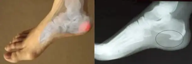 Лечение по традиционной китайской медицине, фотография 4