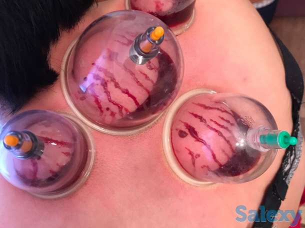 Хиджама Хиджама, фотография 2