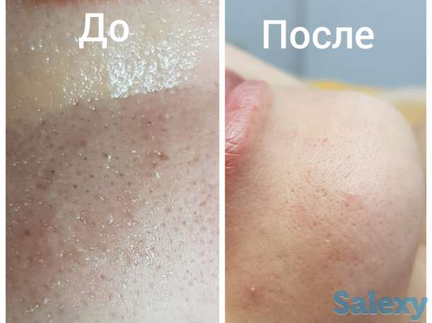 Мужской и Женский Шугаринг в Актау, фотография 3