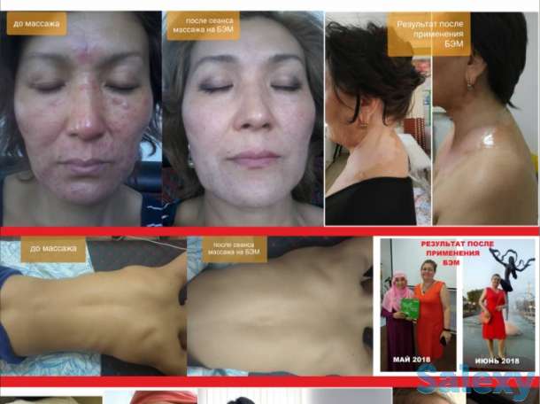 БиоЭнергоМассажер, фотография 3