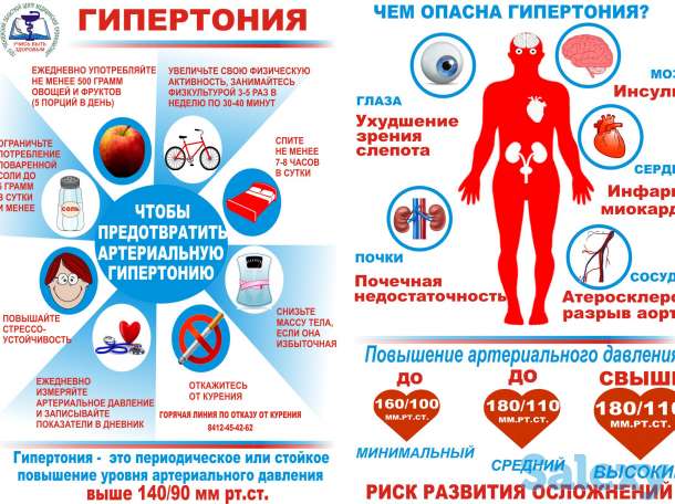 правка атланта, фотография 3