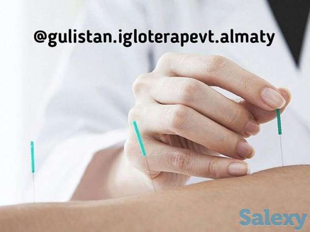 Аккурунктурная пластика лица, фотография 2