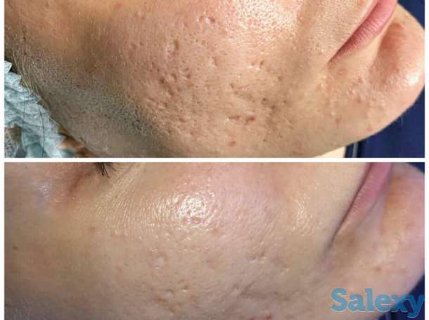 Инновация! BB glou! (тональный крем на год), фотография 7