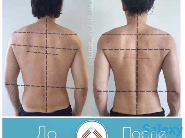 Оздоровительный центр «Айкуне», фотография 5