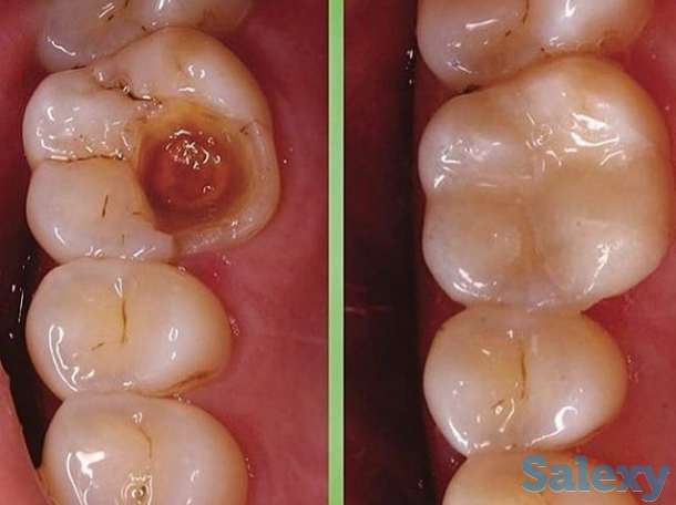 Стоматология, фотография 6