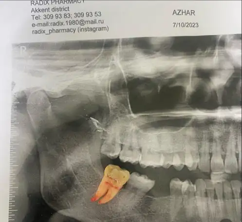 stomotolog24kz, фотография 2