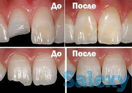Стоматологические услуги от 