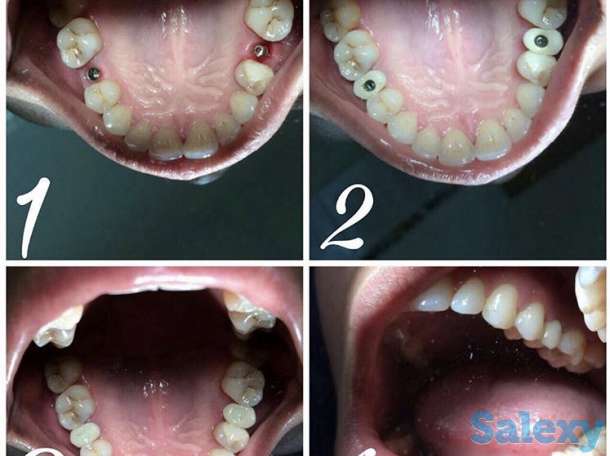 Все виды стоматологических услуг, фотография 1