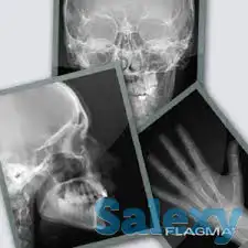 Скупка Рентген Плёнки | Астана - 2023, фотография 7