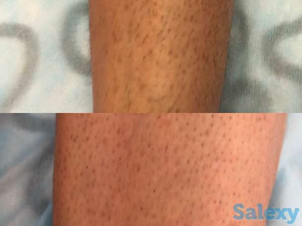 Депиляция | ламинирование, фотография 2