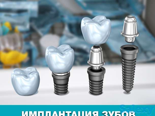 Имплантация зубов в Астане с гарантией!, фотография 1