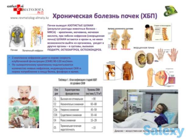 Консультация ревматолога к.м.н. Ph.D. , терапевта высшей категории, 30 летний стаж работы., фотография 3