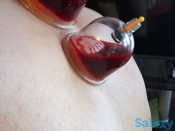 Хиджама, фотография 5