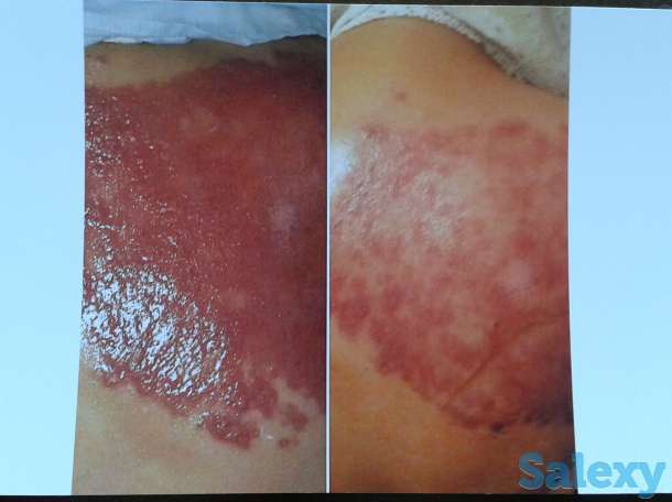 Продам мыло из шунгита, фотография 5