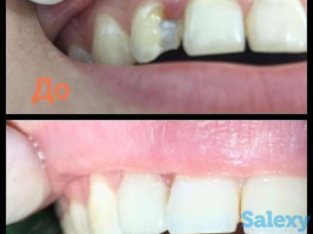 Стоматология, фотография 7