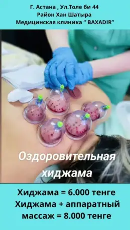 Хиджама в Астане. Услуги хиджамы, фотография 1