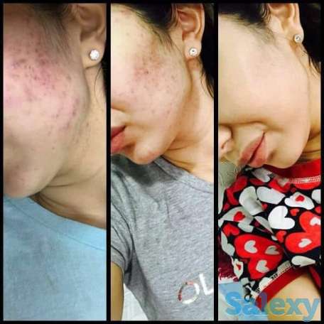 Здоровье и бизнес с продуктом правильного клеточного питания ELEV8 компании BEPIC, фотография 8