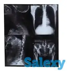 Рентген Плёнка - Утилизация Покупка Сдать Продать Куплю, фотография 2