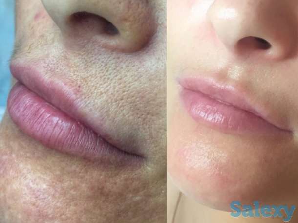 Инновация! BB glou! (тональный крем на год), фотография 2