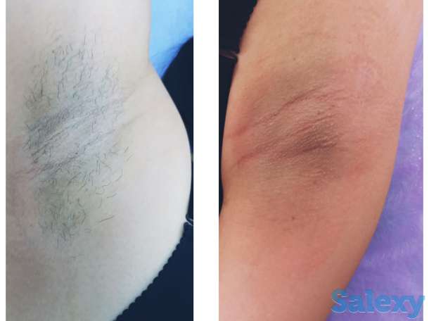 Мастер по шугарингу, фотография 1