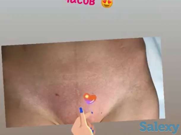 Шугаринг/Депиляция М/Ж, фотография 4