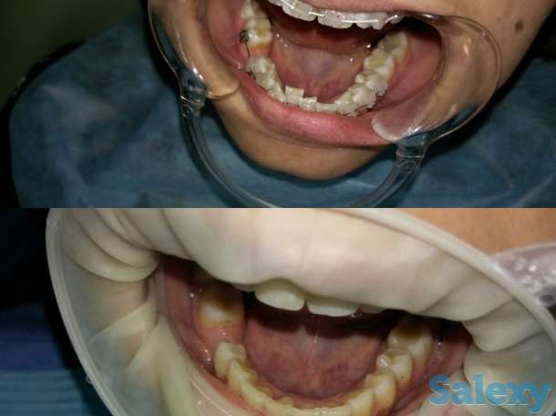 Стоматология доктора Изимова, фотография 4