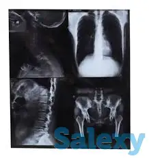 Рентген Плёнка - скупка прием утилизация, фотография 11