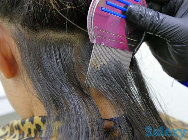 Гребень NitFree от вшей и гнид!, фотография 1