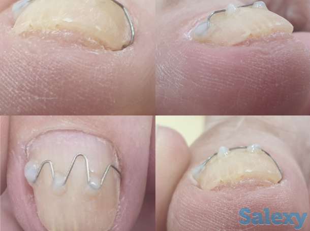 Ноги - наше всё, фотография 5