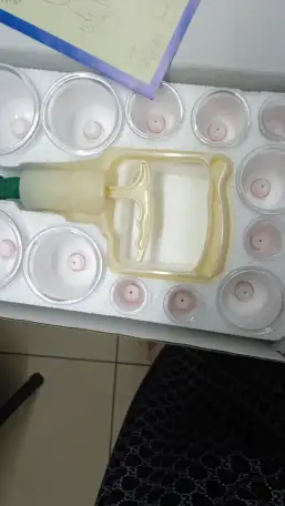 вакуумные банки для хиджама и массажа, фотография 1