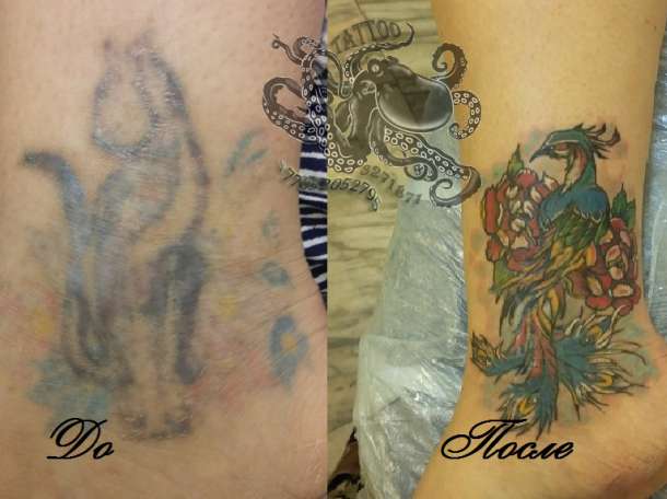 татуировки, татуаж, удаление, фотография 1