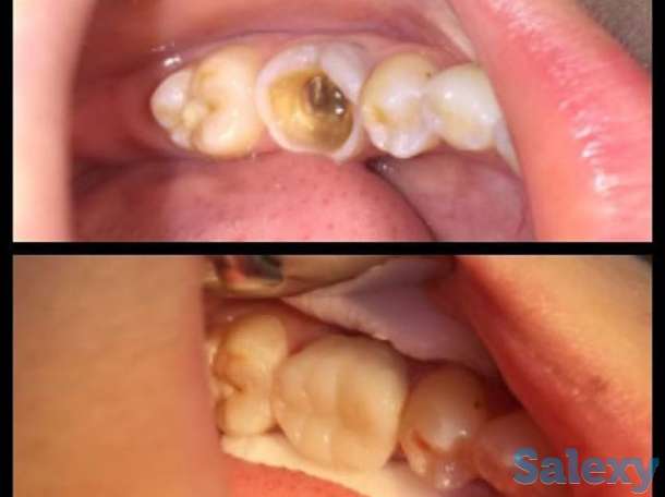 Стоматология, фотография 9