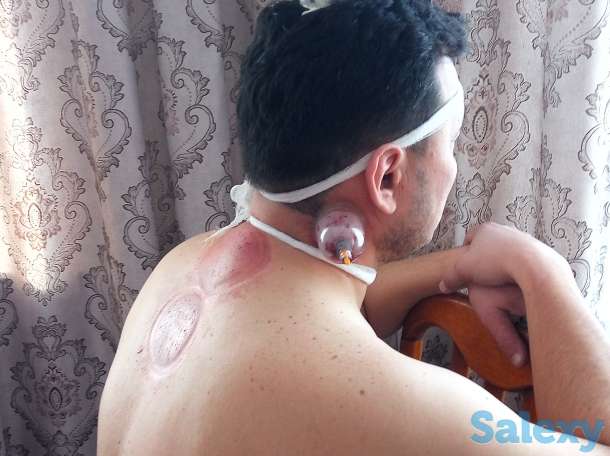 Хиджама, фотография 4