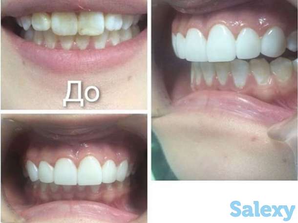 Стоматология, фотография 3