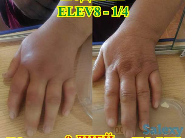 Здоровье и бизнес с продуктом правильного клеточного питания ELEV8 компании BEPIC, фотография 3