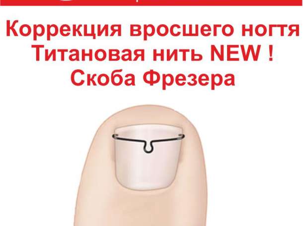 Профилактика сахарного диабета в Алматы, фотография 3